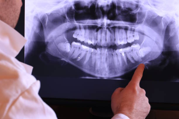 Best Dentist for Severe Toothache  in Packanack Lake, NJ